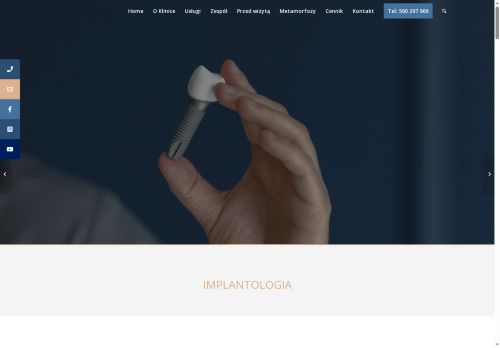 Implanty zębów Toruń Implanty zębów Toruń